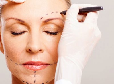 Facial rejuvenation surgery